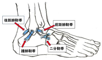 くるぶし 前 距 腓 靭帯