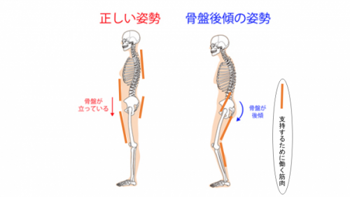 お尻から膝裏にかけての痛みの原因 きちじ整体